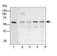 KARI | Ketol-acid reductoisomerase in the group Antibodies Plant/Algal / Developmental Biology / Senescence/Cell death at Agrisera AB (Antibodies for research) (AS15 2879)